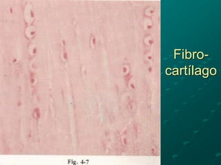 Fibro-
cartílago
 