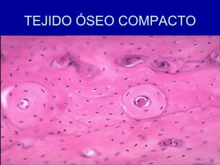 TEJIDO ÓSEO COMPACTO
 