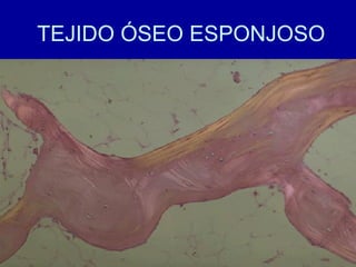 TEJIDO ÓSEO ESPONJOSO
 