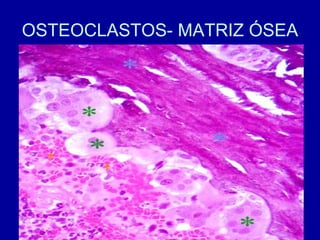 OSTEOCLASTOS- MATRIZ ÓSEA
 