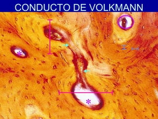 CONDUCTO DE VOLKMANN
 