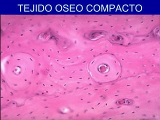 TEJIDO OSEO COMPACTO
 