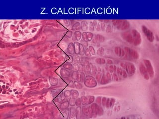 Z. CALCIFICACIÓN
 