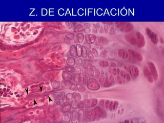 Z. DE CALCIFICACIÓN
 