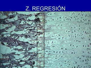Z. REGRESIÓN
 