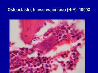 Osteoclasto, hueso esponjoso (H-E), 1000X
 