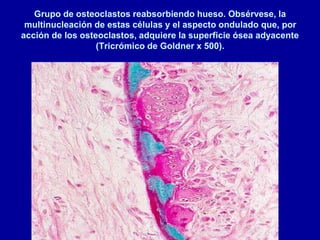 Grupo de osteoclastos reabsorbiendo hueso. Obsérvese, la
multinucleación de estas células y el aspecto ondulado que, por
acción de los osteoclastos, adquiere la superficie ósea adyacente
(Tricrómico de Goldner x 500).
 