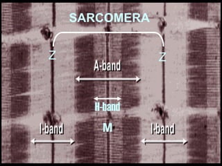 Z Z
SARCOMERA
H-band
M
 