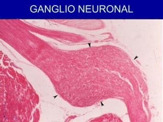 GANGLIO NEURONAL
 