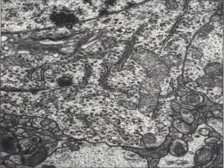 Fragmento de un pequeño soma
neural
 