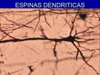 ESPINAS DENDRITICAS
 
