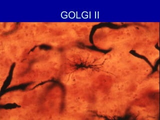 GOLGI II
 