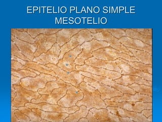 EPITELIO PLANO SIMPLE
MESOTELIO
 