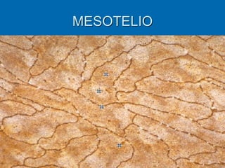 MESOTELIO
 