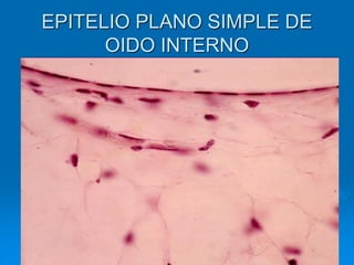 EPITELIO PLANO SIMPLE DE
OIDO INTERNO
 