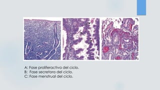 A: Fase proliferactiva del ciclo.
B: Fase secretora del ciclo.
C: Fase menstrual del ciclo.
 