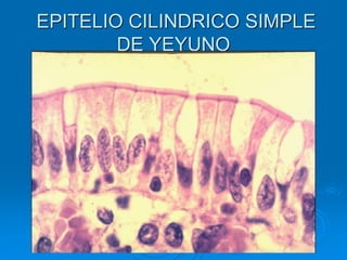 EPITELIO CILINDRICO SIMPLE
DE YEYUNO
 