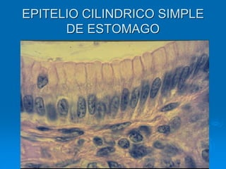 EPITELIO CILINDRICO SIMPLE
DE ESTOMAGO
 