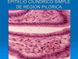 EPITELIO CILINDRICO SIMPLE
DE REGION PILORICA
 