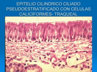 EPITELIO CILINDRICO CILIADO
PSEUDOESTRATIFICADO CON CELULAS
CALICIFORMES- TRAQUEAL
 