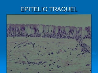 EPITELIO TRAQUEL
 