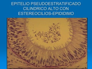 EPITELIO PSEUDOESTRATIFICADO
CILINDRICO ALTO CON
ESTEREOCILIOS-EPIDIDIMO
 