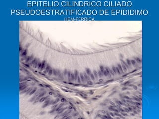 EPITELIO CILINDRICO CILIADO
PSEUDOESTRATIFICADO DE EPIDIDIMO
HEM-FERRICA
 