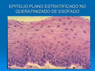 EPITELIO PLANO ESTRATIFICADO NO
QUERATINIZADO DE ESOFAGO
 