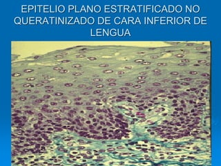 EPITELIO PLANO ESTRATIFICADO NO
QUERATINIZADO DE CARA INFERIOR DE
LENGUA
 