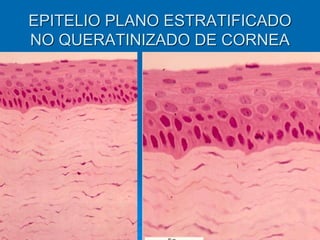 EPITELIO PLANO ESTRATIFICADO
NO QUERATINIZADO DE CORNEA
 