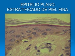 EPITELIO PLANO
ESTRATIFICADO DE PIEL FINA
 