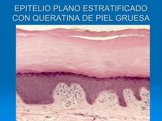EPITELIO PLANO ESTRATIFICADO
CON QUERATINA DE PIEL GRUESA
 