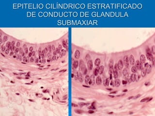 EPITELIO CILÍNDRICO ESTRATIFICADO
DE CONDUCTO DE GLANDULA
SUBMAXIAR
 
