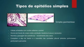 Tipos de epitélios simples
Simples pavimentoso
 Células achatadas com núcleo saliente e central
 Ocorre em locais do corpo onde a proteção mecânica é pouco necessária
 Permite a passagem de substâncias - revestimento dos vasos
 Compõem a alça de Henle e o mesotélio das cavidades pleural (alvéolos pulmonares),
peritoneal e pericárdia
 