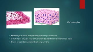 De transição
 Modificação especial do epitélio estratificado pavimentosos
 O número de células e suas formas variam de acordo com a distensão do órgão
 Ocorre revestindo internamente a bexiga urinária
 