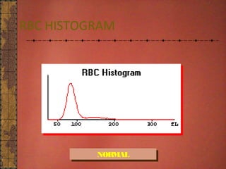 CBC Histogram DR NARMADA PRASAD TIWARI | PPT