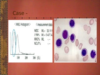 CBC Histogram DR NARMADA PRASAD TIWARI | PPT