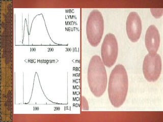 CBC Histogram DR NARMADA PRASAD TIWARI | PPT