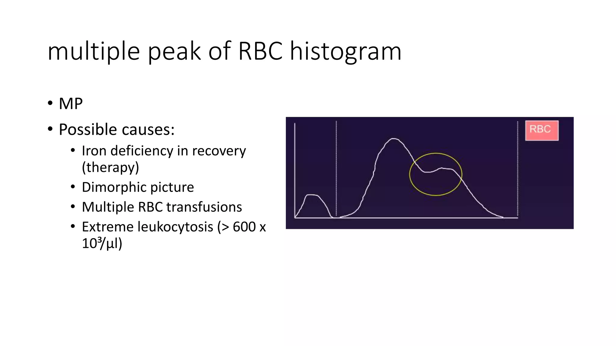 multiple peak of RBC histogram
• MP
• Possible causes:
• Iron deficiency in recovery
(therapy)
• Dimorphic picture
• Multiple RBC transfusions
• Extreme leukocytosis (> 600 x
10³/µl)
 