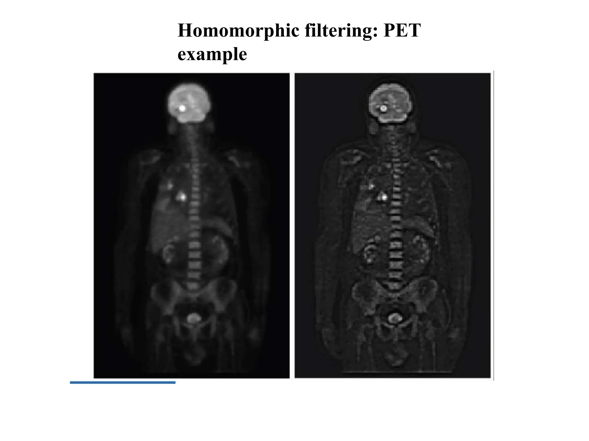 Homomorphic filtering: PET
example
 