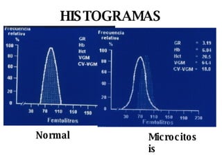 HISTOGRAMAS Normal Microcitosis 