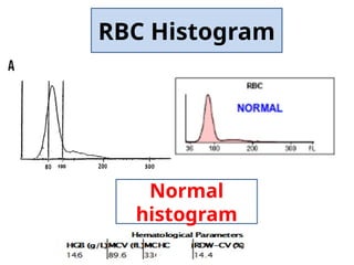 Histogram Dr Dina Adel important to read CBC | PPTX
