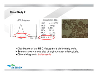 Histogram Interpretation for result analysis | PDF