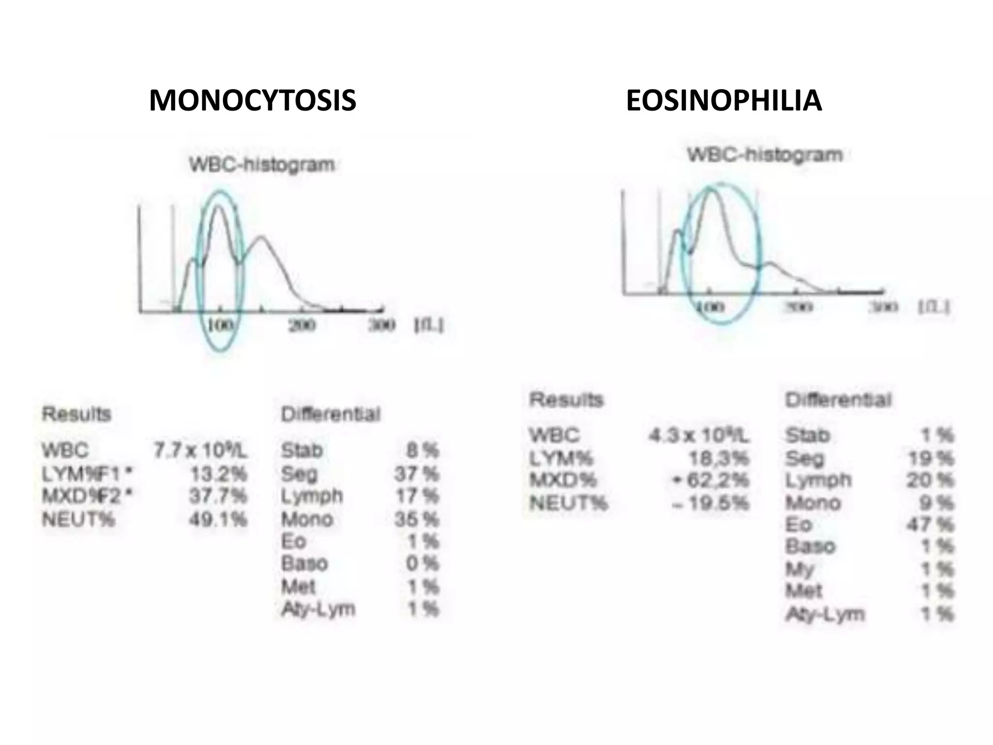 MONOCYTOSIS EOSINOPHILIA
 
