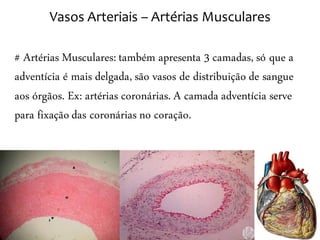Vasos Arteriais – Artérias Musculares

# Artérias Musculares: também apresenta 3 camadas, só que a
adventícia é mais delgada, são vasos de distribuição de sangue
aos órgãos. Ex: artérias coronárias. A camada adventícia serve
para fixação das coronárias no coração.
 