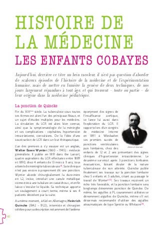 40
Aujourd’hui, derrière ce titre un brin racoleur, il n’est pas question d’aborder
de scabreux épisodes de l’histoire de la médecine et de l’expérimentation
humaine, mais de mettre en lumière la genèse de deux techniques, de nos
jours largement répandues à tout âge, et qui trouvent – toute ou partie – de
leur origine dans la médecine pédiatrique.
HISTOIRE DE
LA MÉDECINE
LES ENFANTS COBAYES
La ponction de Quincke
Fin du XIXème
siècle. La tuberculose sous toutes
ses formes est alors l’un des principaux fléaux, et
un sujet d’études multiples pour les médecins.
La circulation du LCR est alors bien connue,
ainsi que la symptomatologie de la méningite
et ses complications : céphalées, hypertension
intracrânienne, convulsions. De là l’idée d’une
soustraction de LCR dans un but thérapeutique.
L’un des premiers à s’y essayer est un anglais,
Walter Essex Wynter (1860 – 1945) : médecin
généraliste. Il publie en 1891 dans the Lancet,
quatre aspirations du LCR effectuées entre 1889
et 1890, chez 4 enfants de 13 mois à 11 ans, tous
atteintsdeméningitetuberculeuse(1)
.Satechnique
n’est pas encore à proprement dit une ponction.
Wynter aborde chirurgicalement la dure-mère
en L2, incise, introduit une canule métallique
connectée à une tubulure en caoutchouc, et enfin
laisse s’écouler le liquide. Sa technique apporte
un soulagement à court terme, même si ses 4
patients décèdent par la suite.
Au même moment, à Kiel en Allemagne, Heinrich
Quincke (1842 – 1922), interniste et chirurgien
célèbrepoursadescriptionnotammentdel’œdème
éponymeet des signes de
l’insuffisance aortique,
se lance lui aussi dans
l’exploration du LCR. Il
rapporte lors d’un congrès
de médecine interne
en 1891 à Wiesbaden
ses premiers succès de
ponctions ventriculaires
puis lombaires, chez des
enfants de 12 et 2 ans présentant des signes
cliniques d’hypertension intracrânienne. Le
deuxième survécut après 3 ponctions lombaires
évacuatrices, faisant douter de la nature
tuberculeuse de son atteinte. Quincke publie
finalement ses travaux sur la ponction lombaire
chez 5 enfants et 5 adultes, citant au passage le
travail de Wynter(2,3)
. Ses travaux reçoivent un
écho très favorable, et la ponction lombaire sera
longtemps dénommée ponction de Quincke. De
même, les aiguilles à PL couramment utilisées se
dénomment aiguilles de Quincke, même s’il est
désormais recommandé d’utiliser des aiguilles
atraumatiques de type Sprotte ou Whitacre(4)
.
Heinrich Quincke
 