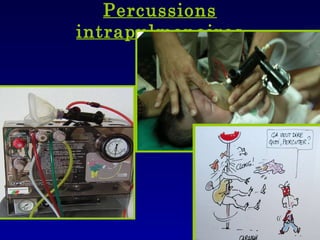 Percussions intrapulmonaires 