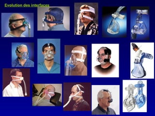 Evolution des interfaces 
