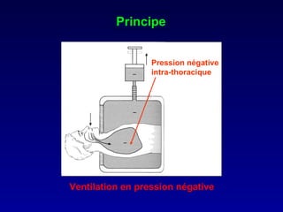 Principe Ventilation en pression négative Pression négative intra - thoracique 