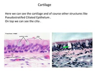 Cartilage

Here we can see the cartilage and of course other structures like
Pseudostratifed Ciliated Epithelum .
On top we can see the cilia .
 